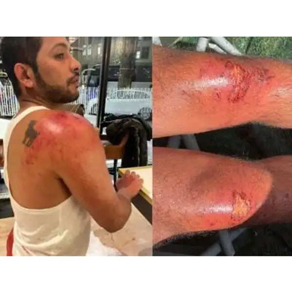 Entertainment News-  रोहित शेट्टी के शो खतरों के खिलाड़ी में इन सेलेब्स को लगी चोटें, देखे तस्वीरें